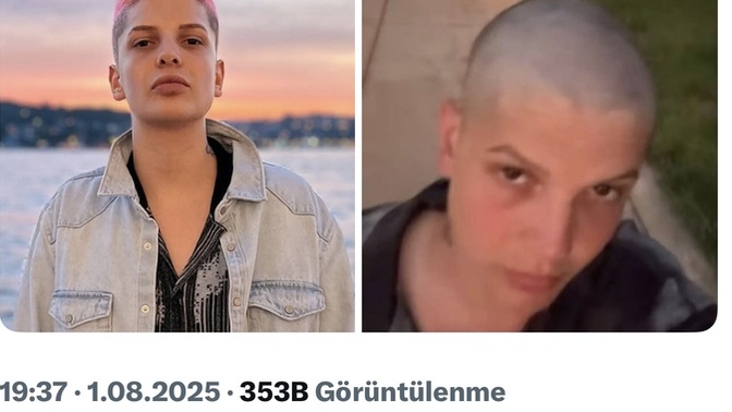Ebrar karakurt saçını kazıttı, ne düşünüyorsunuz, nasıl olmuş?