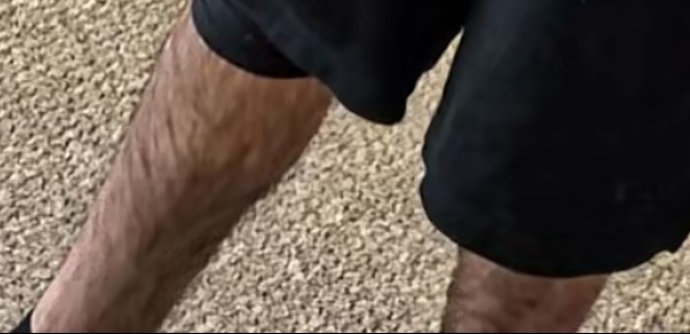 Bir erkeğin bacağında bu kadar kıl abartı mı yoksa normal mi?