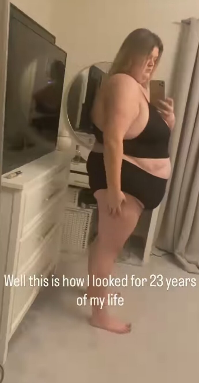 Şu kadının kilo verme değişimi şakamı?