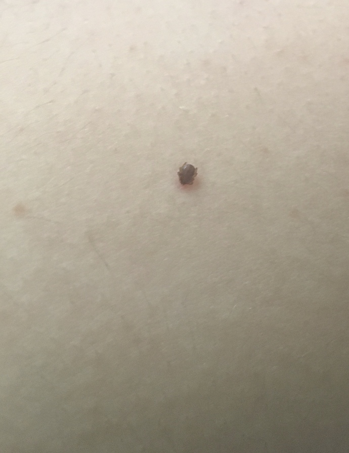 Size hiç kene yapıştı mı?