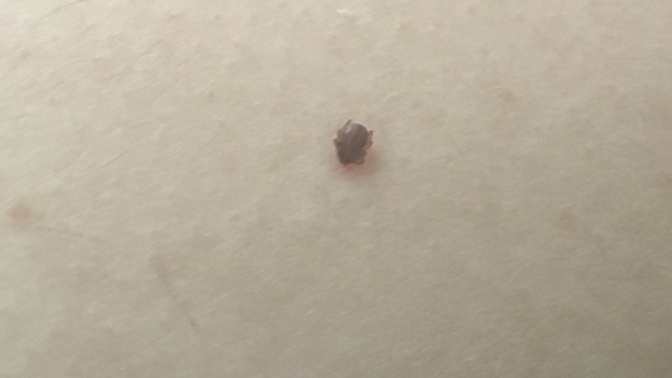 Size hiç kene yapıştı mı?