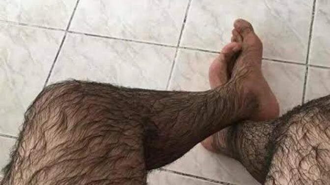 Bacak kılı alınmalı mı?