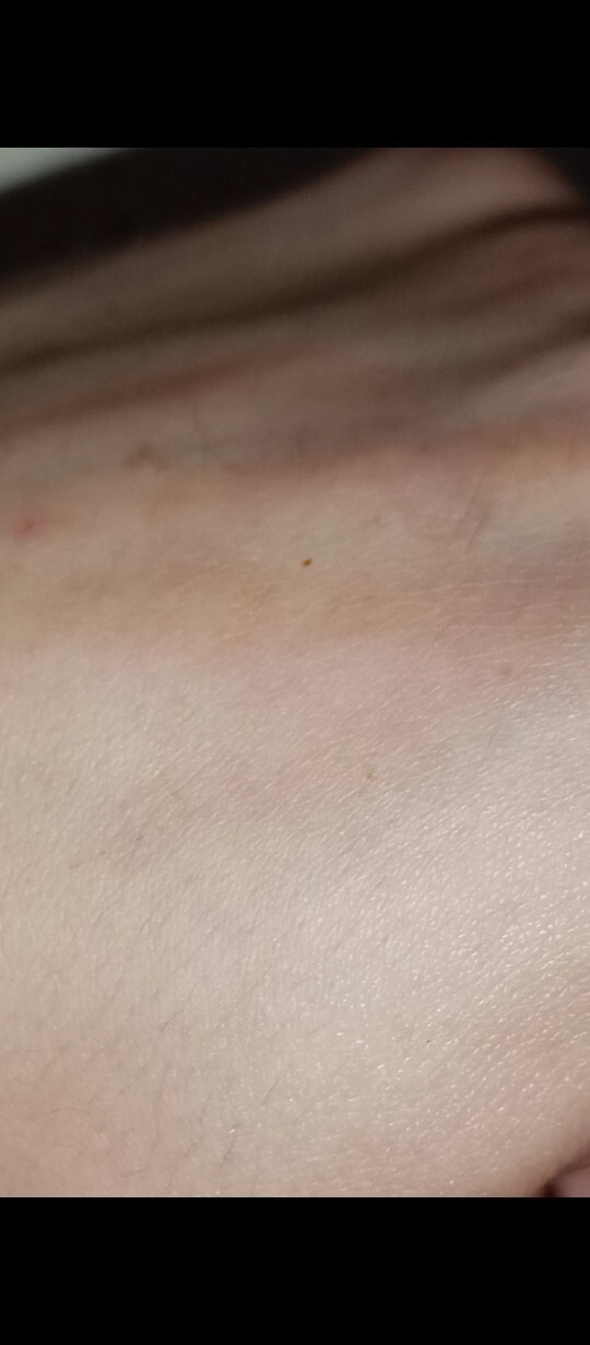 Bu nedir kafayı yiyeceğim artık?