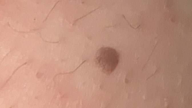 Kene mi bu çok korkuyorum?