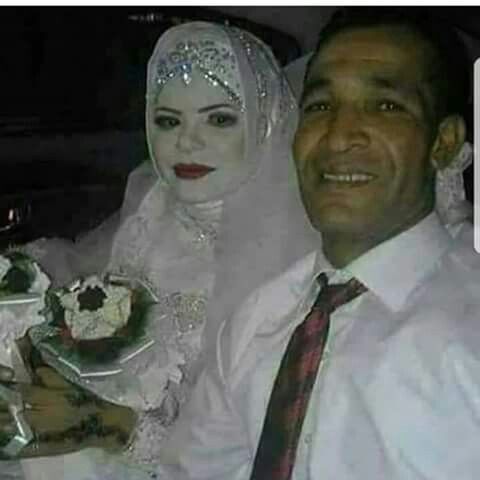 Yemeğinizde kıl çıkarsa iştahınız kaçar mı 🌼?