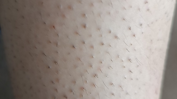 Kızlar ağdadan sonra neden böyle oluyor?