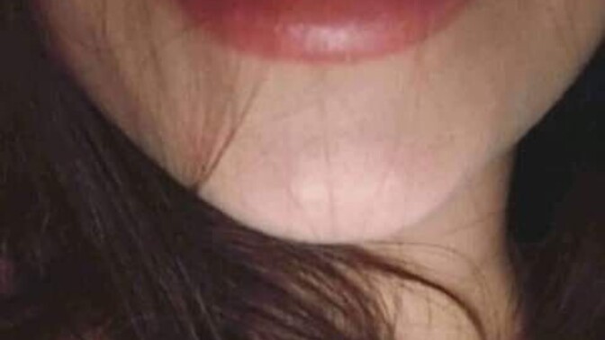 Dişlerin inci gibi güzel midir?