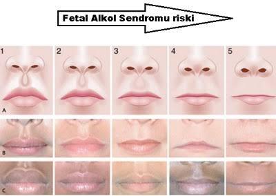 Filtrum, yüz ifadesine çok şey katabiliyor. Sizin için buradaki bölge özel bir anlam taşıyor mu?