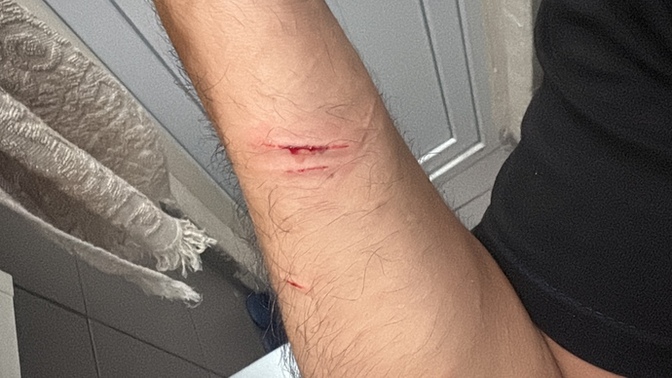 Kedi tırmaladı, bileklerimi kestim sandılar?😂?