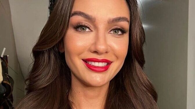 Birce akalay yüzümde hiç estetik ve işlem yok demiş. Katılıyor musunuz?