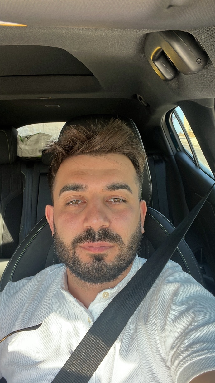 Gözlerimin sürekli böyle kısık olması problem mi?