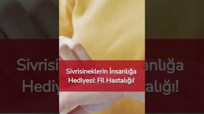 Sivrisineklerin İnsanlığa Hediyesi: Fil Hastalığı?