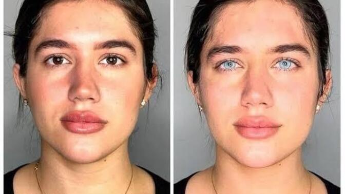 Göz 👁️ rengin ne? Memnun musun? Göz 👁️ rengi değişimine nasıl bakıyorsun?
