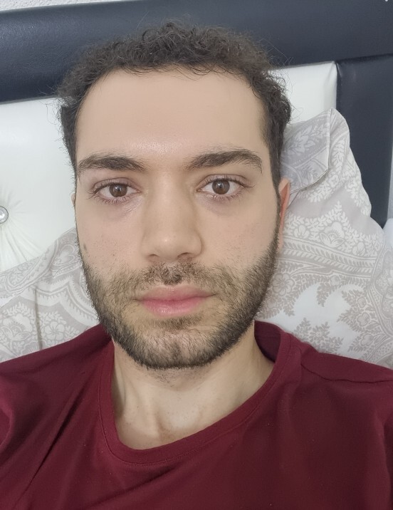 Sarılmaya ihtiyaçım var çok bunaldım?