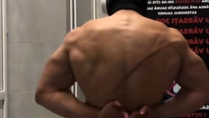 Yara izleri çekici mi, rahatsız edici mi geliyor size?