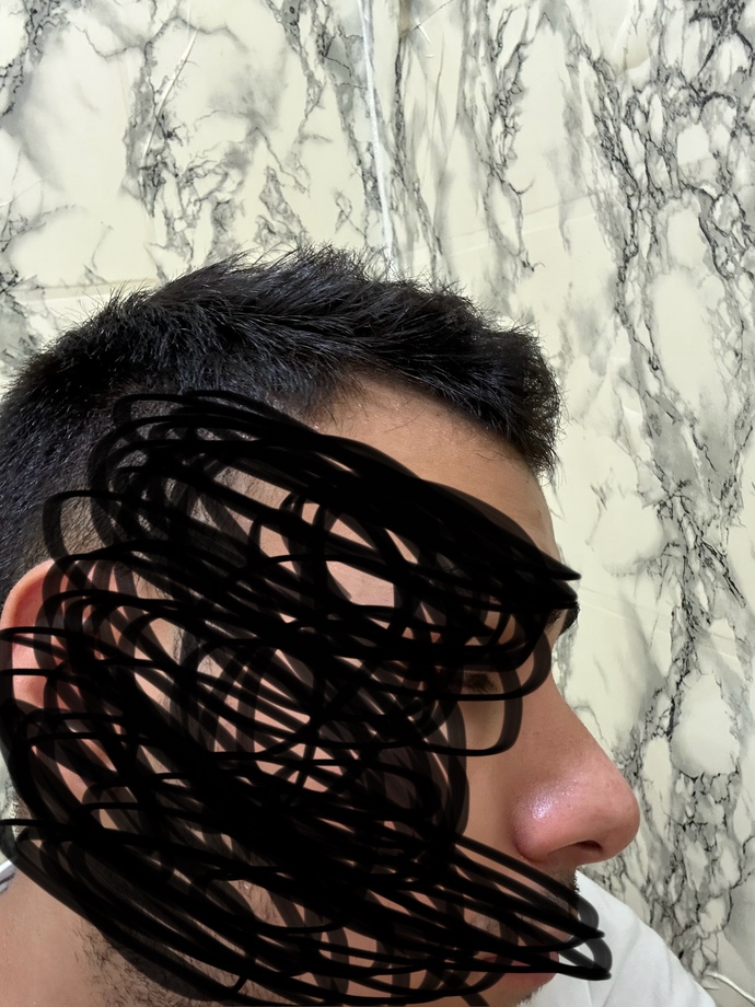 Sizce burnuma estetiğe gerek var mı tipim değişsin de istiyorum tamamen sizce kötü mü?