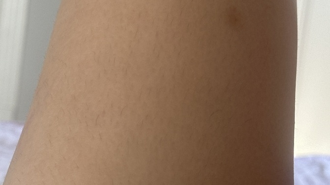 Bacağimda böyle kısa kıllar varken dışarı şort giyilir mi?