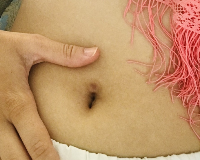 Kapanan piercing deliğini yeniden deldirmek hakkında ne düşünüyorsunuz?