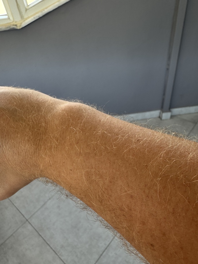 Bu kadar kıl çıkması normal mi lütfen linçlemeyin?