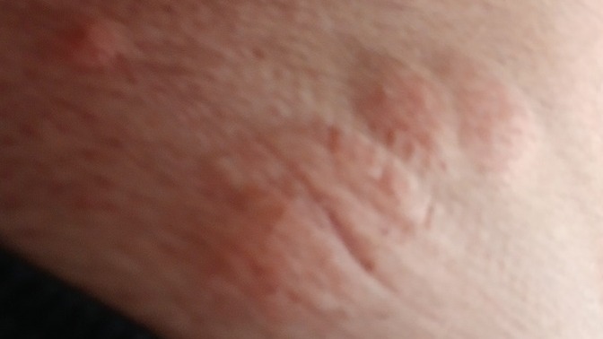 Bu nedir ya kasiniyor kasidikca buyuyor vucudumun her yerini sarmis?