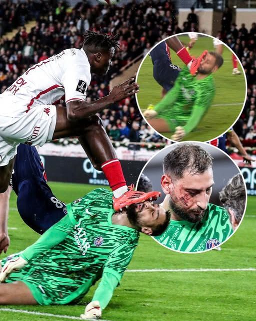 Galatasaray, Monaco'dan Wilfried Singo'yu transfer etti. Sizce faydalı olur mu?