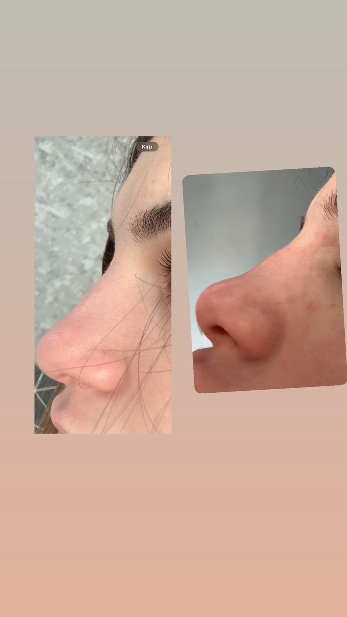 Burnum eskiye göre bozulmuş mu?