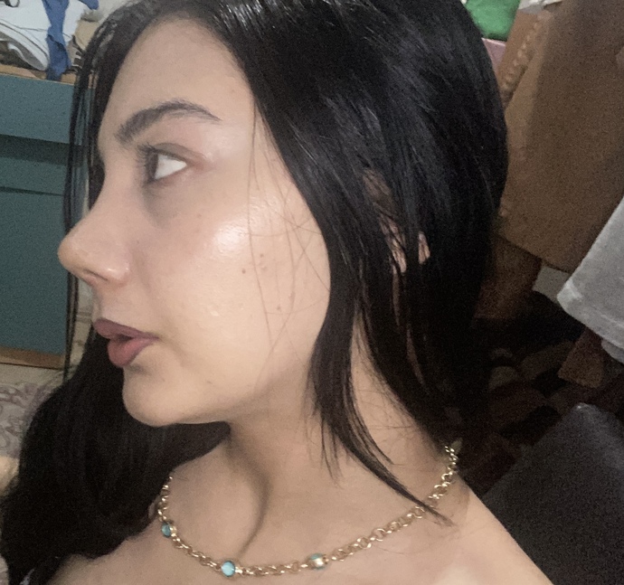 Amelıyatın üçüncü ayı nası duruyo sızce?