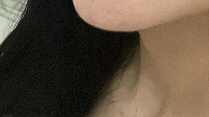 Dudaklarımın dolguya ıhtıyacı var mı sizce?