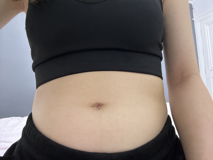 2günde 46buçuk kilodan 49a yaklaşmam normal mi?