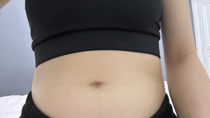 2günde 46buçuk kilodan 49a yaklaşmam normal mi?