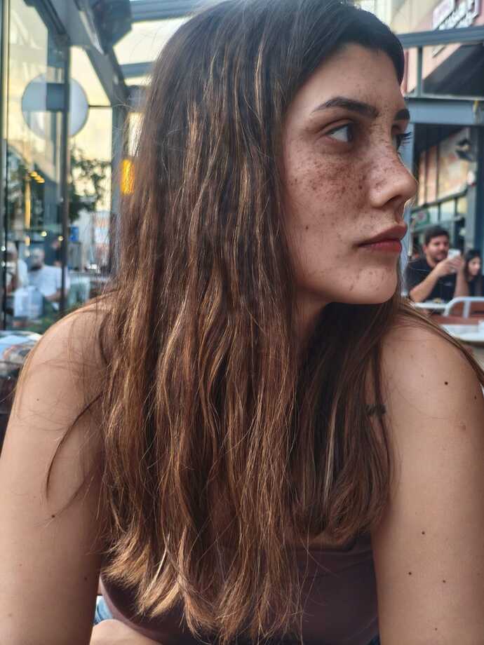 Tekrar burun estetiği olmalı mıyım burnum kötü duruyor mu sizce kusurlu olan yerleri yazarmisiniz?