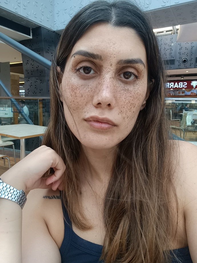 Tekrar burun estetiği olmalı mıyım burnum kötü duruyor mu sizce kusurlu olan yerleri yazarmisiniz?