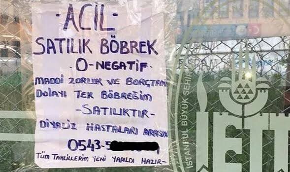 Para karşılığında her hangi bir organını satar mıydın?