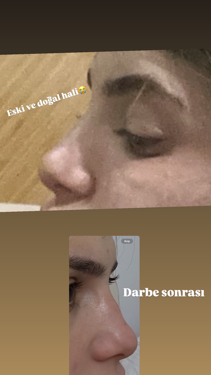 Eskiye göre çok bozulmuş di mi?