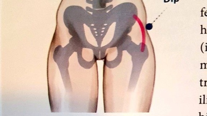 Hip dips problemi?