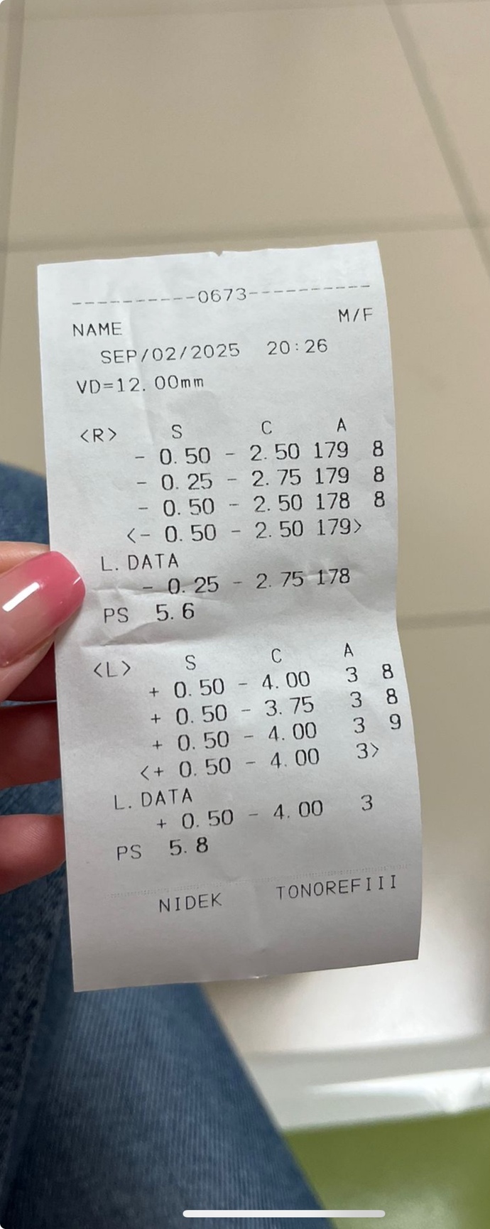 Göz numaram böyle olmasına rağmen günlük hayatta rahatsız olmuyorum normal mi?