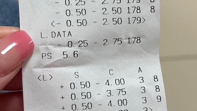 Göz numaram böyle olmasına rağmen günlük hayatta rahatsız olmuyorum normal mi?