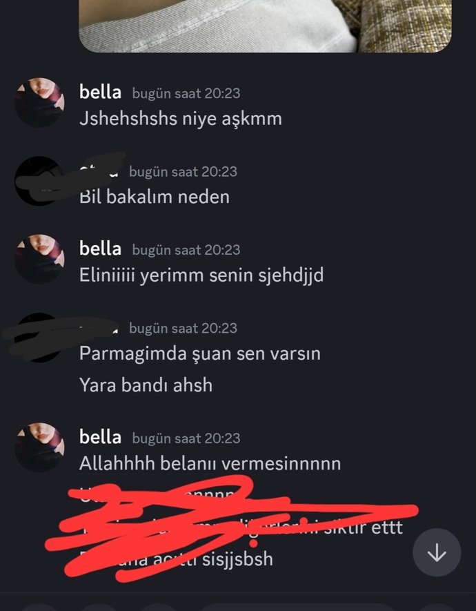 Acıttı biraz shhsjshsh