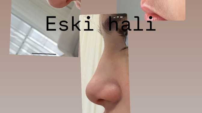 Estetik cerrahları 6 aydan önce müdehale edemezmiş bu doğru mu?
