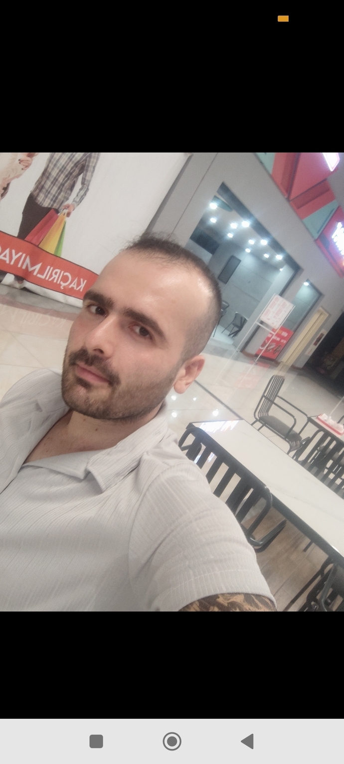 Saçı çok erken dökmüşüm demi?