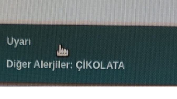 Sizin de böyle alerjileriniz var mı?