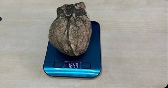 Kalbinizin durumu ne?