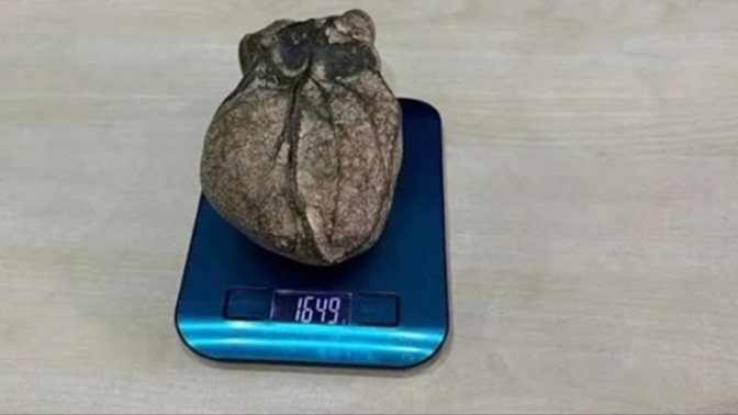Kalbinizin durumu ne?