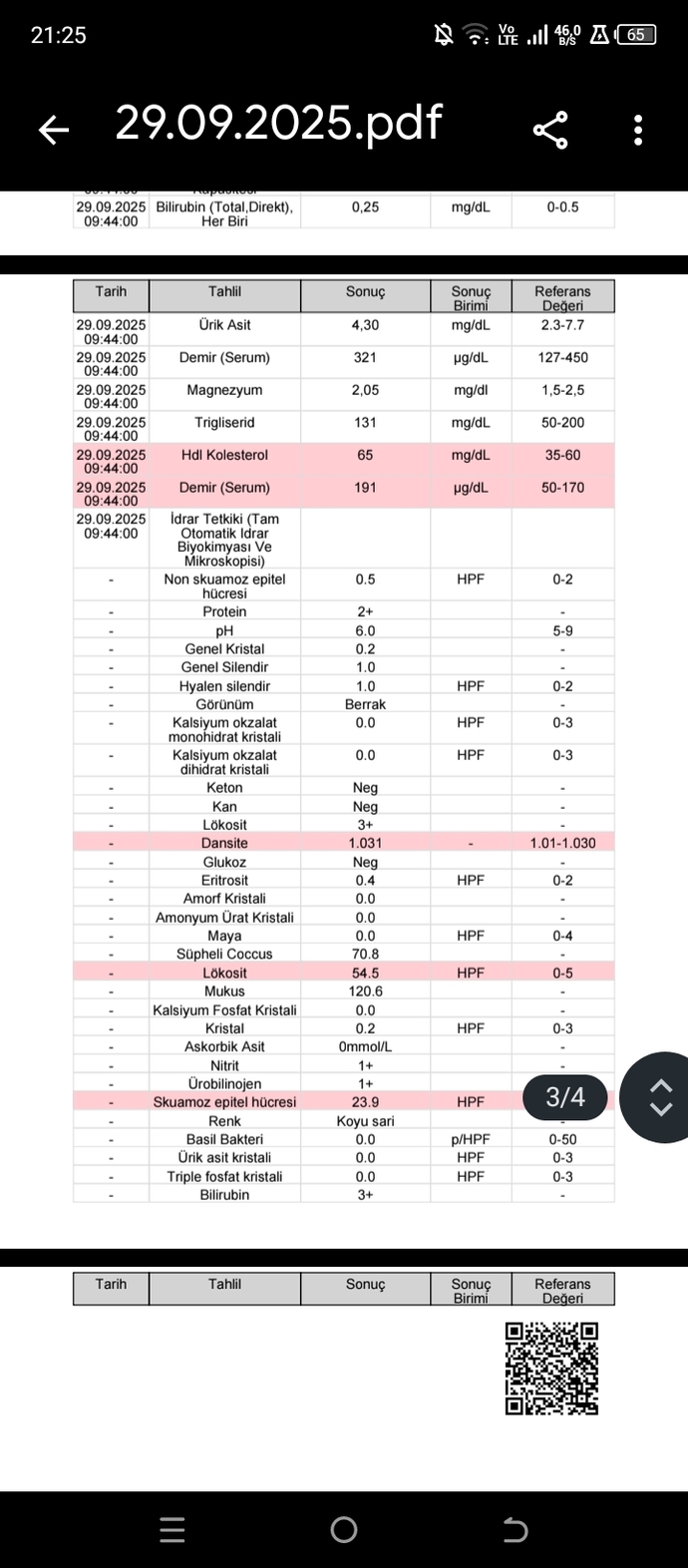 Tahlilden anlayabilecek biri var mı?