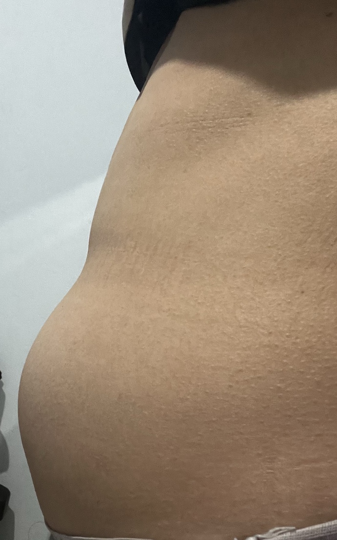 163 boy 51 kiloyum güne düz karınla başlıyorum ama gün içinde yediklerimden sonra durum bu hafif şeyler yediğim halde?