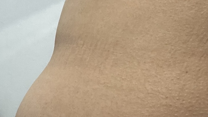 163 boy 51 kiloyum güne düz karınla başlıyorum ama gün içinde yediklerimden sonra durum bu hafif şeyler yediğim halde?