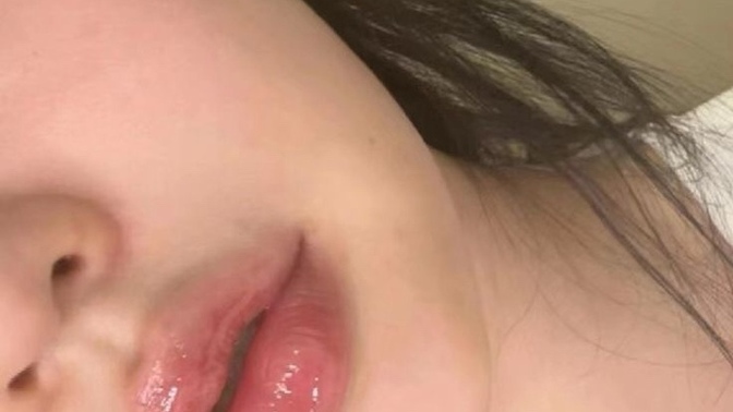 Dudak dolgusu yapınca his kaybı oluyor mu?