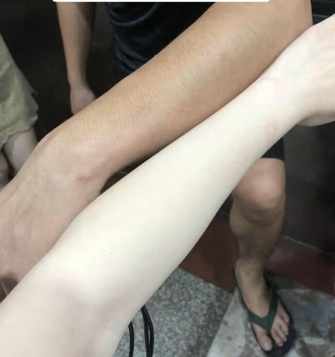 Çabuk bronzlaşır mısınızz ten renginiz nedir?