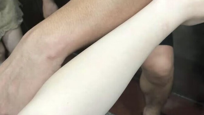 Çabuk bronzlaşır mısınızz ten renginiz nedir?