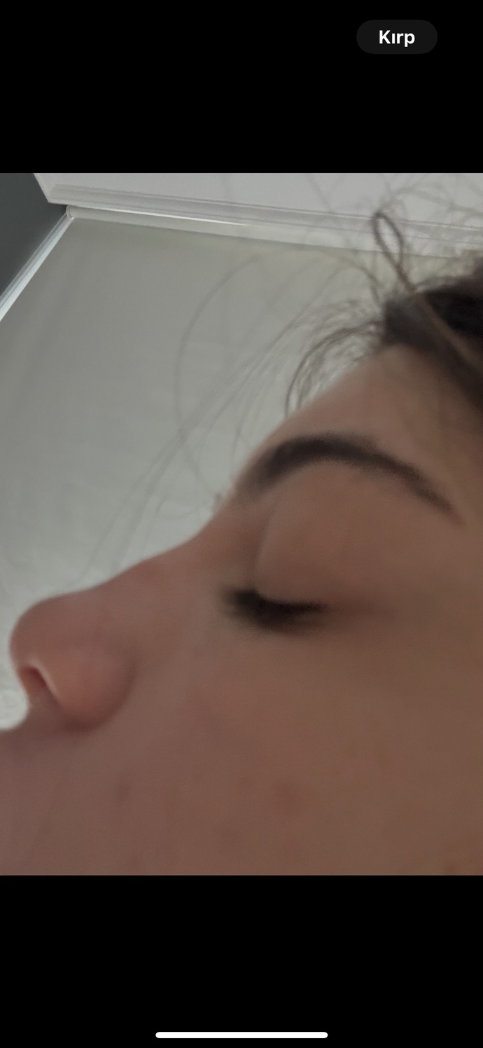 Burnumun sırt kısmı eğri mi duruyor?